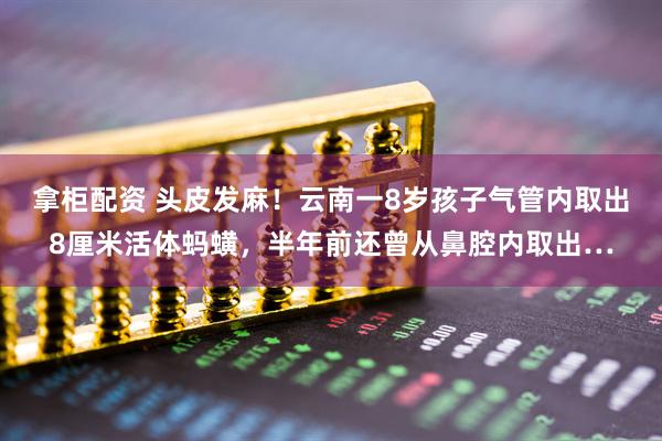 拿柜配资 头皮发麻！云南一8岁孩子气管内取出8厘米活体蚂蟥，半年前还曾从鼻腔内取出…